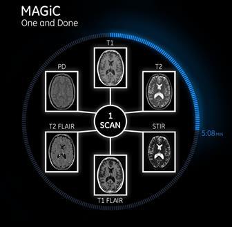 高性能の画像再構築技術MAGiC（MAGnetic resonance image Compilation）を業界初搭載
